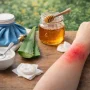 What is a good remedy for bee stings